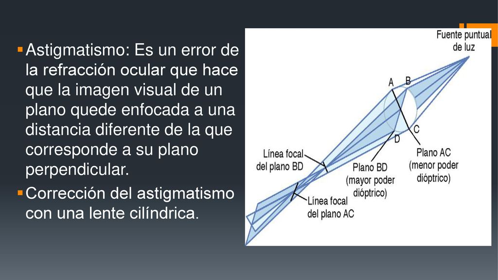 Astigmatismo: Es un error de la refracción ocular que hace que la imagen visual de un plano quede enfocada a una distancia diferente de la que corresponde a su plano perpendicular.