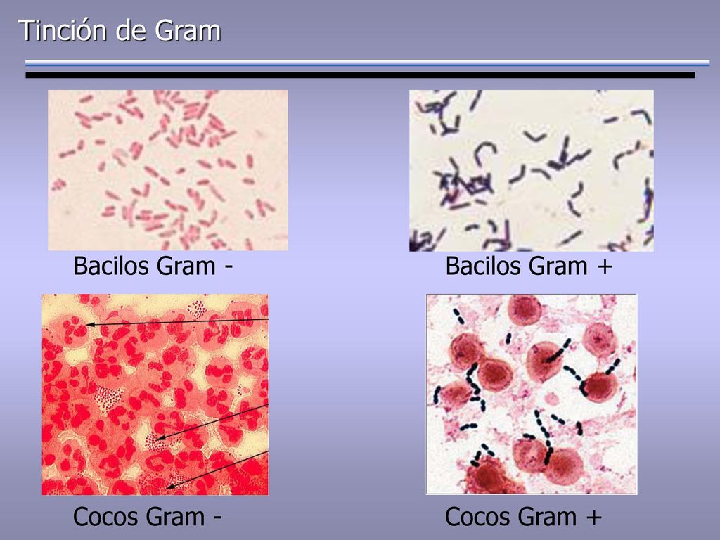 Tinción de Gram Bacilos Gram - Bacilos Gram + Cocos Gram -