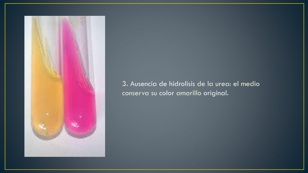 3. Ausencia de hidrolisis de la urea: el medio conserva su color amarillo original.