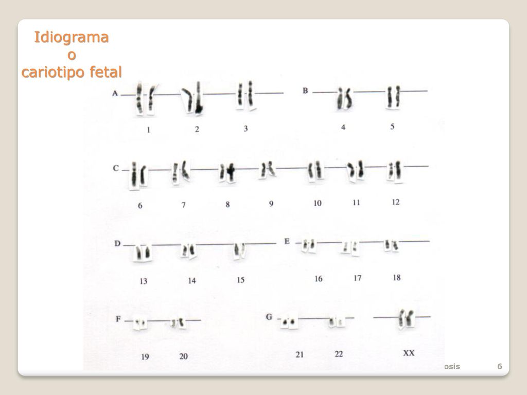 Idiograma o cariotipo fetal Tema 2: Mitosis y meiosis