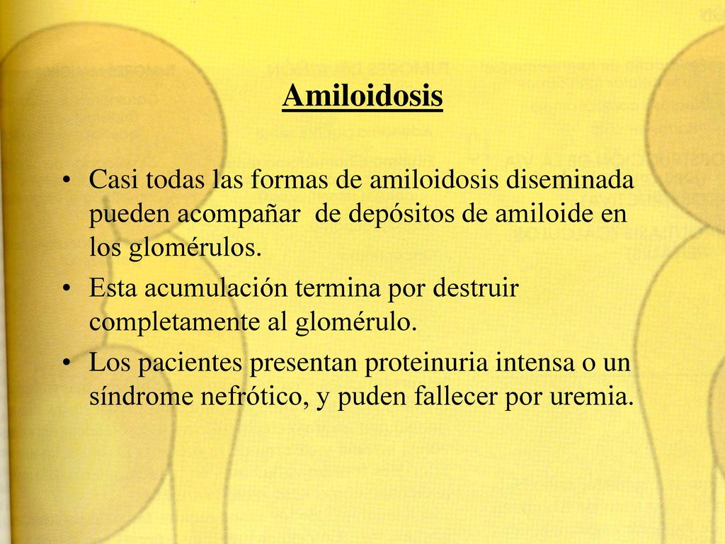 Amiloidosis Casi todas las formas de amiloidosis diseminada pueden acompañar de depósitos de amiloide en los glomérulos.
