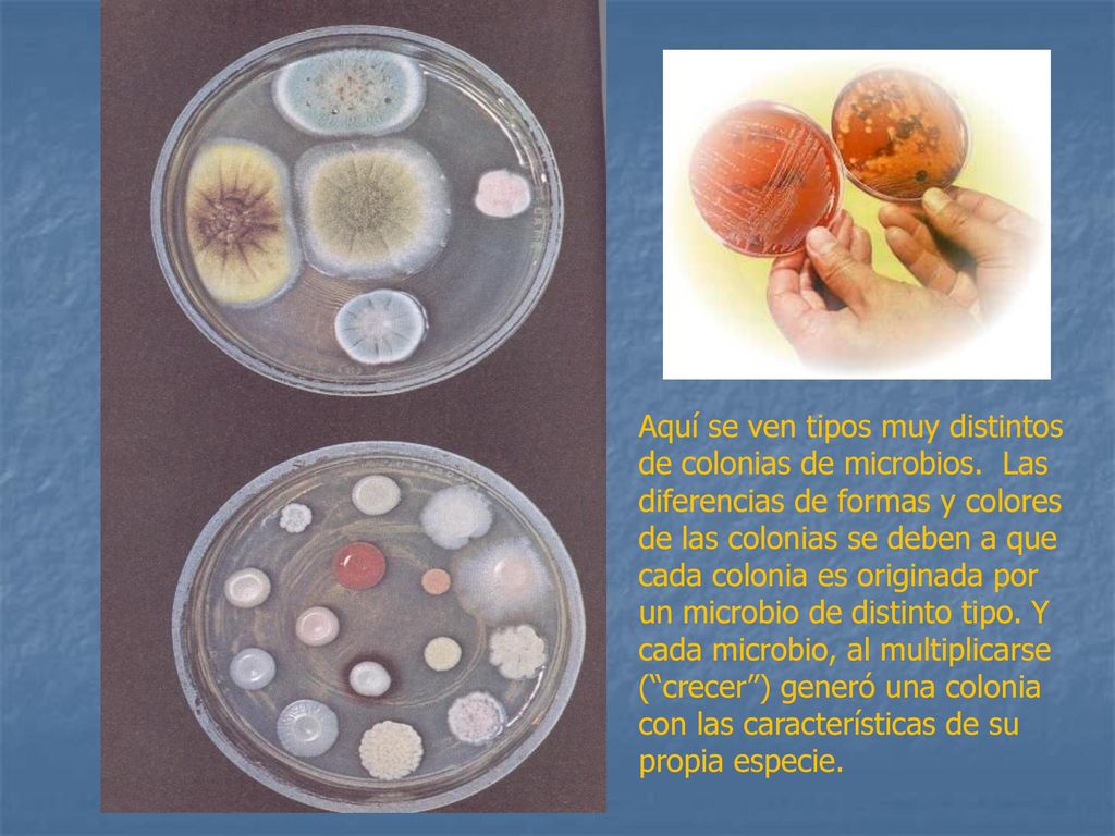 Aquí se ven tipos muy distintos de colonias de microbios