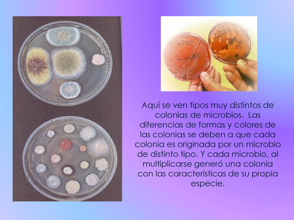 Aquí se ven tipos muy distintos de colonias de microbios