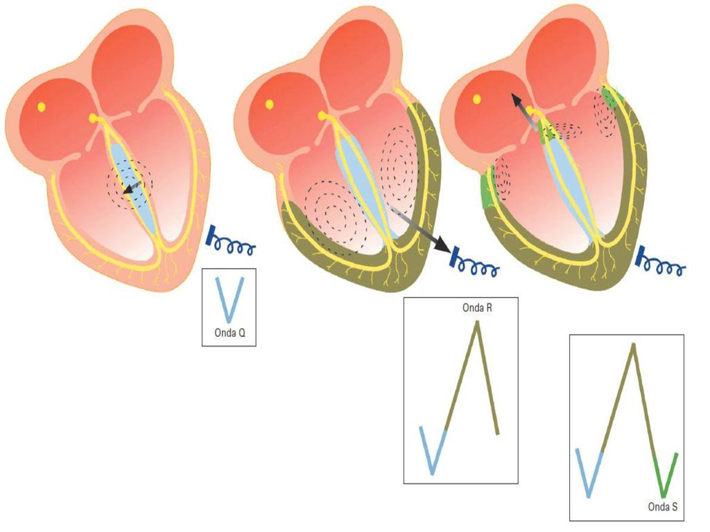 Figura 27-8 Secuencia de despolarización del ventrículo y generación del complejo QRS del ECG.