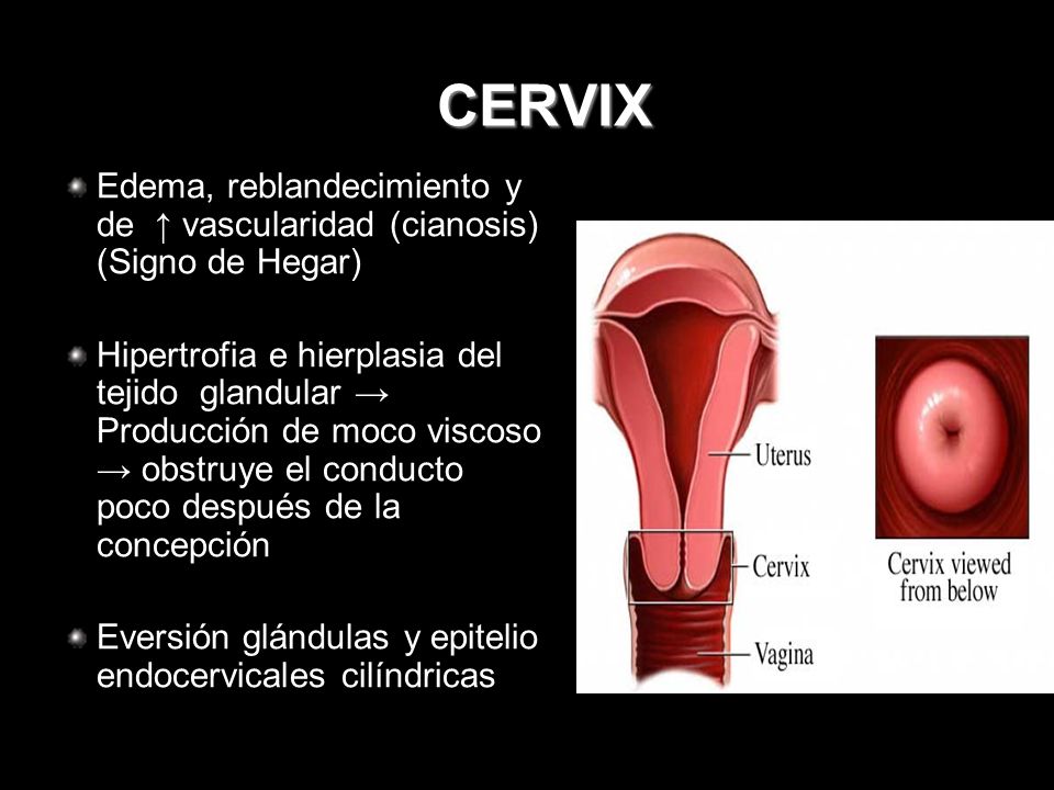 CERVIX Edema, reblandecimiento y de ↑ vascularidad (cianosis) (Signo de Hegar)