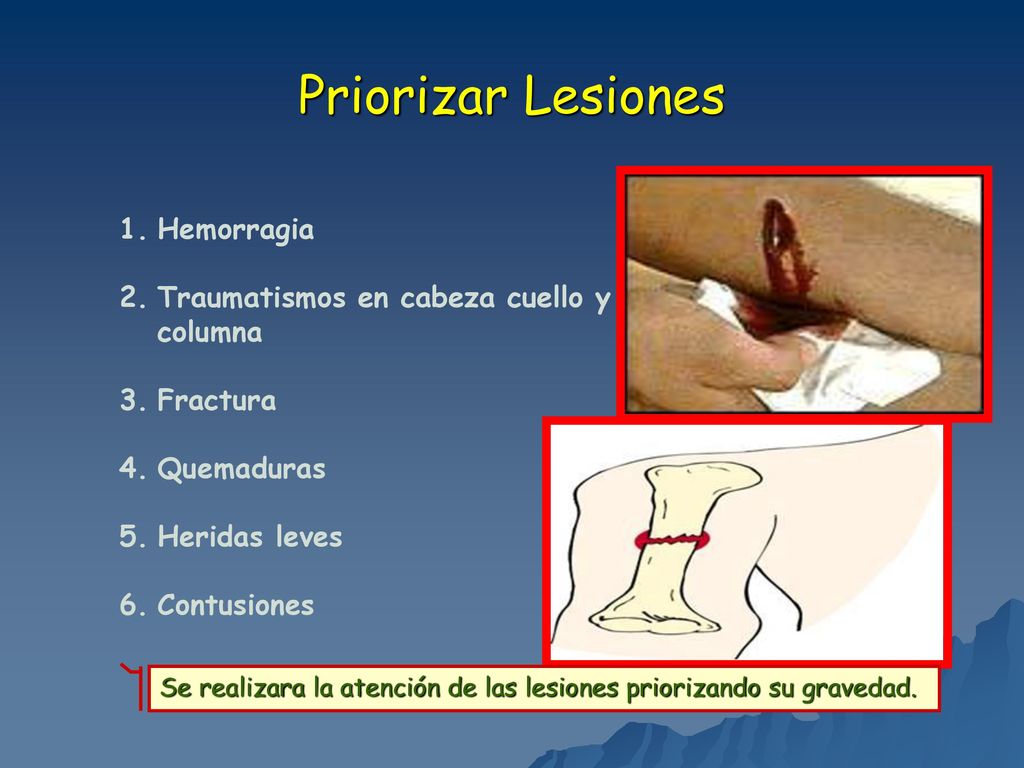 Priorizar Lesiones Hemorragia Traumatismos en cabeza cuello y columna