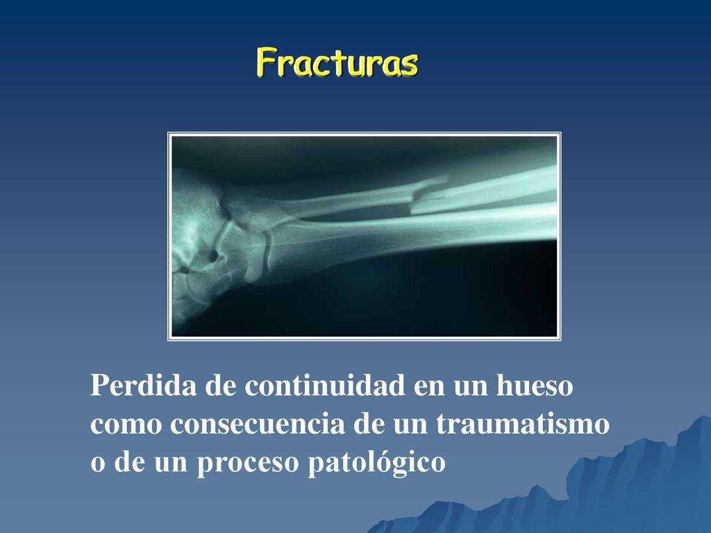 Fracturas Perdida de continuidad en un hueso como consecuencia de un traumatismo o de un proceso patológico.