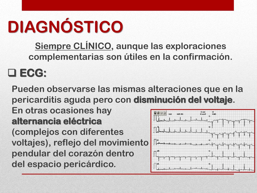 DIAGNÓSTICO Siempre CLÍNICO, aunque las exploraciones complementarias son útiles en la confirmación.