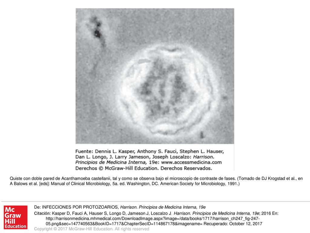 Quiste con doble pared de Acanthamoeba castellanii, tal y como se observa bajo el microscopio de contraste de fases. (Tomado de DJ Krogstad et al., en A Balows et al. [eds]: Manual of Clinical Microbiology, 5a. ed. Washington, DC. American Society for Microbiology, 1991.)
