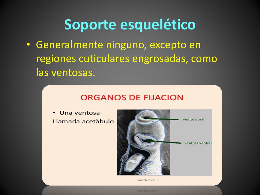 Soporte esquelético Generalmente ninguno, excepto en regiones cuticulares engrosadas, como las ventosas.