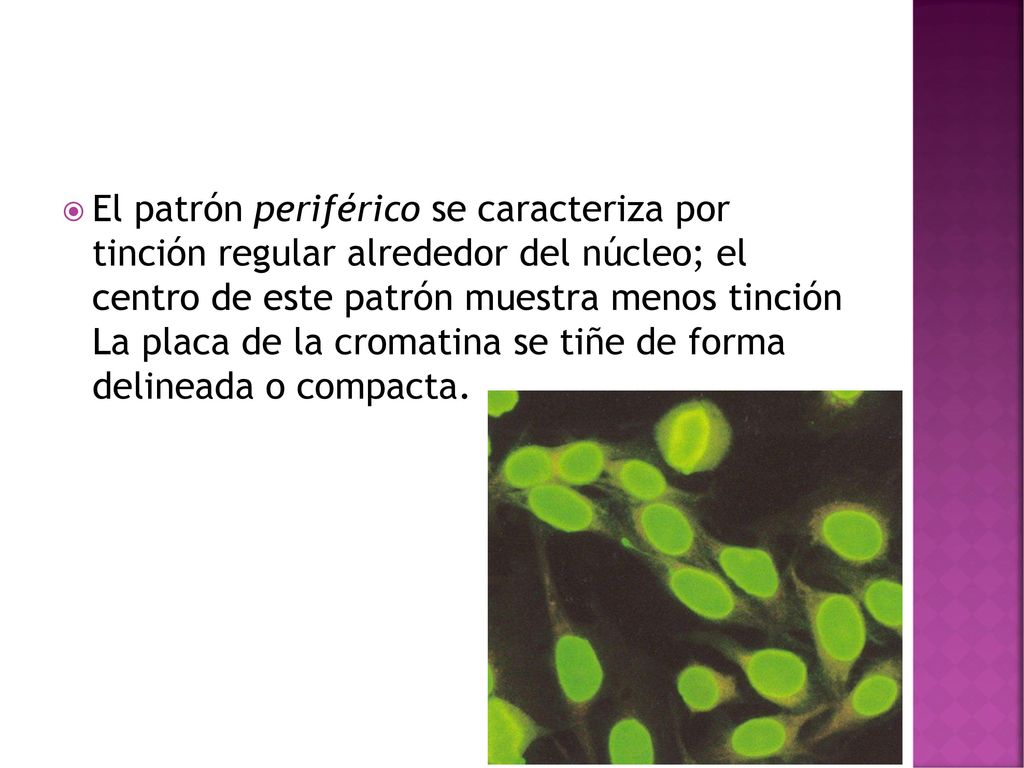 El patrón periférico se caracteriza por tinción regular alrededor del núcleo; el centro de este patrón muestra menos tinción La placa de la cromatina se tiñe de forma delineada o compacta.