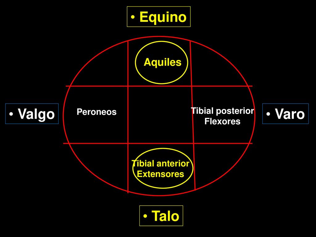 Equino Valgo Varo Talo Aquiles Peroneos Tibial posterior Flexores