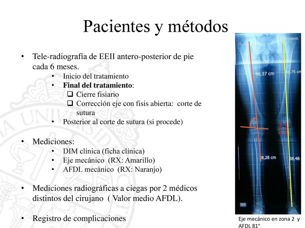 Pacientes y métodos Tele-radiografía de EEII antero-posterior de pie cada 6 meses. Inicio del tratamiento.
