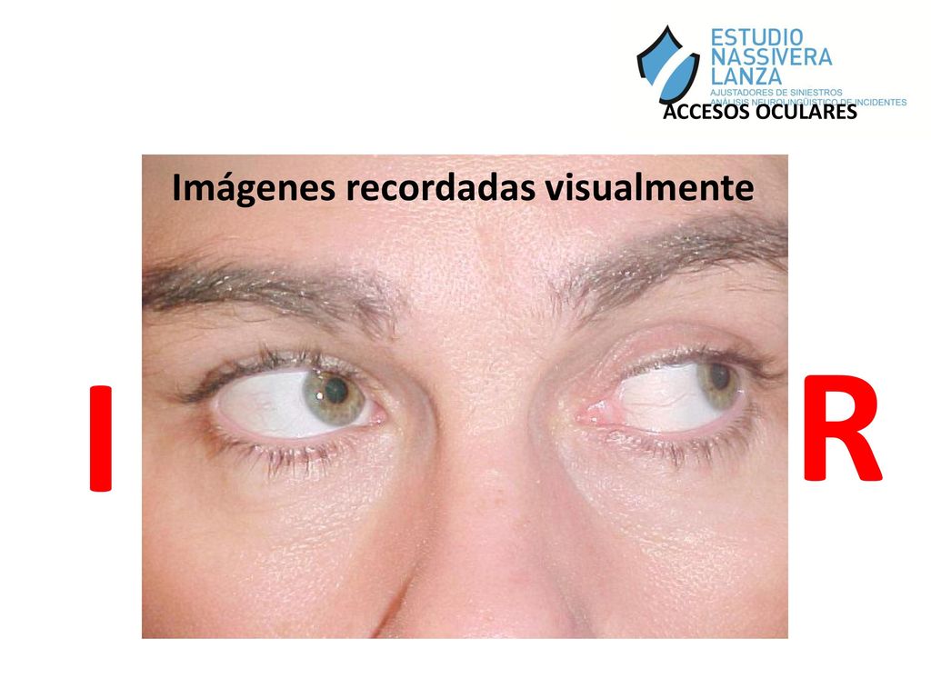 ACCESOS OCULARES Imágenes recordadas visualmente I R