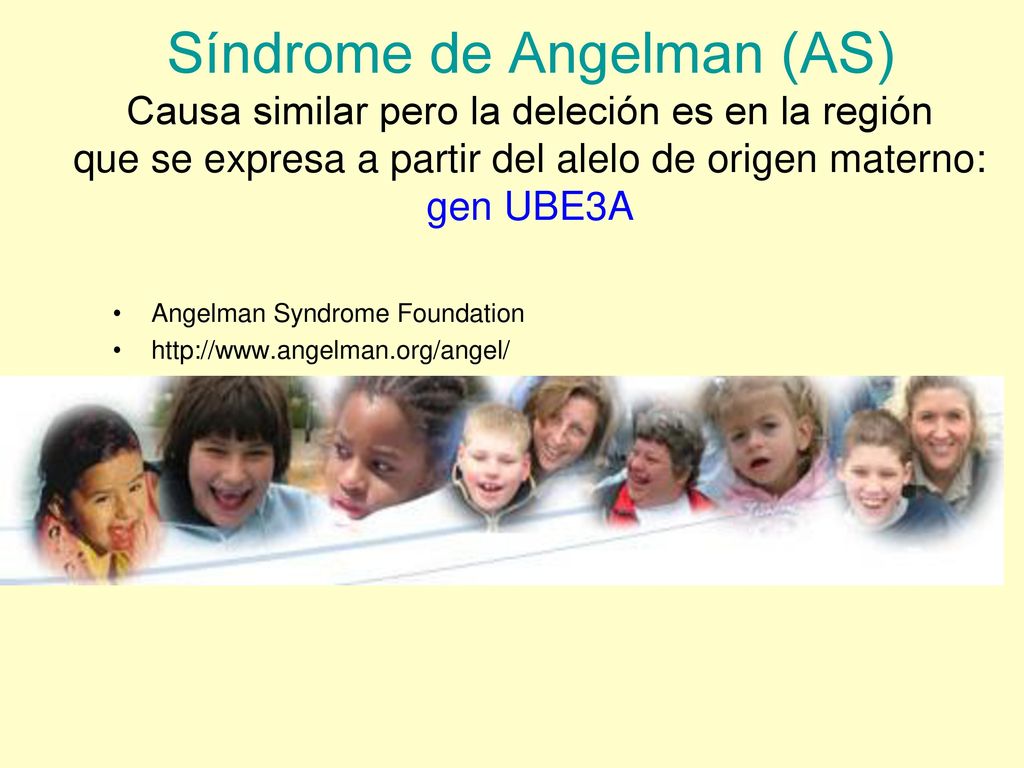 Síndrome de Angelman (AS) Causa similar pero la deleción es en la región que se expresa a partir del alelo de origen materno: gen UBE3A