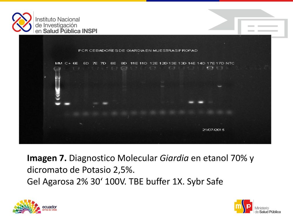 Imagen 7. Diagnostico Molecular Giardia en etanol 70% y dicromato de Potasio 2,5%.