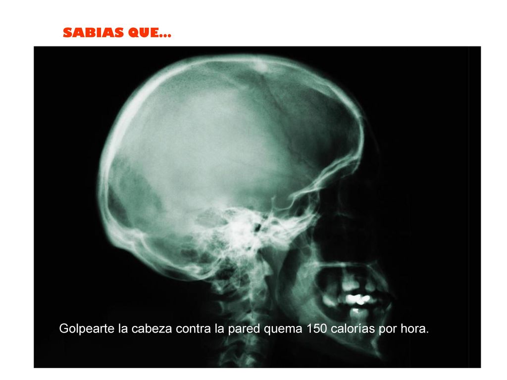 Golpearte la cabeza contra la pared quema 150 calorías por hora.