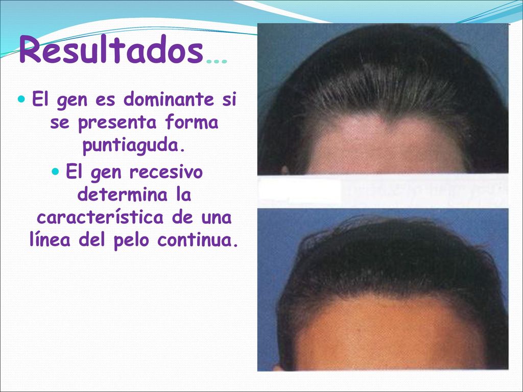 El gen es dominante si se presenta forma puntiaguda.
