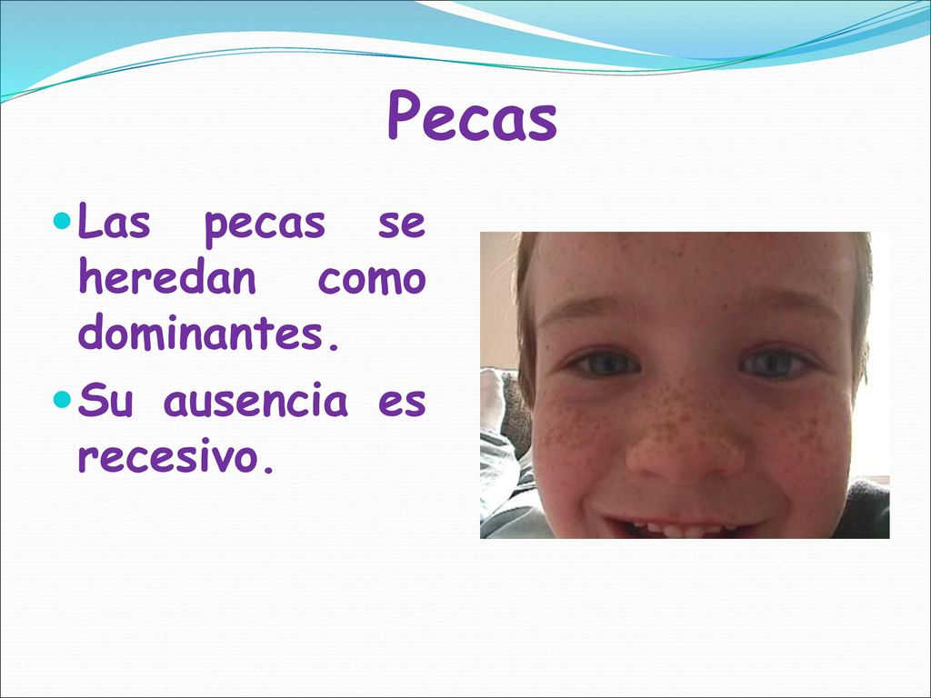 Pecas Las pecas se heredan como dominantes. Su ausencia es recesivo.