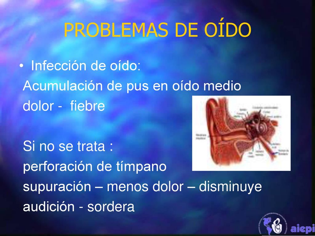 PROBLEMAS DE OÍDO Infección de oído: Acumulación de pus en oído medio