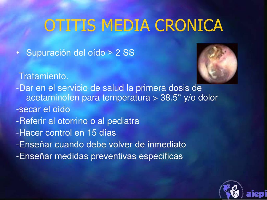 OTITIS MEDIA CRONICA Supuración del oído > 2 SS Tratamiento.
