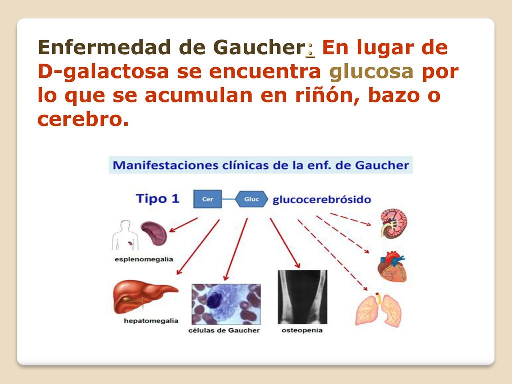 Enfermedad de Gaucher: En lugar de D-galactosa se encuentra glucosa por lo que se acumulan en riñón, bazo o cerebro.