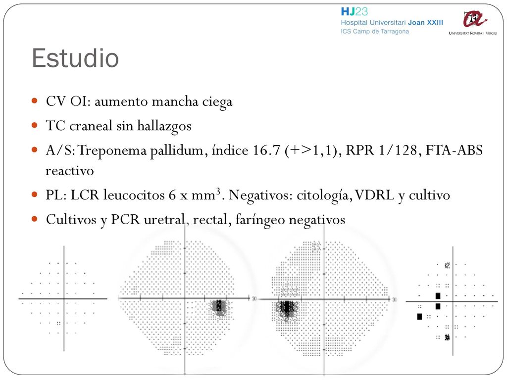 Estudio CV OI: aumento mancha ciega TC craneal sin hallazgos