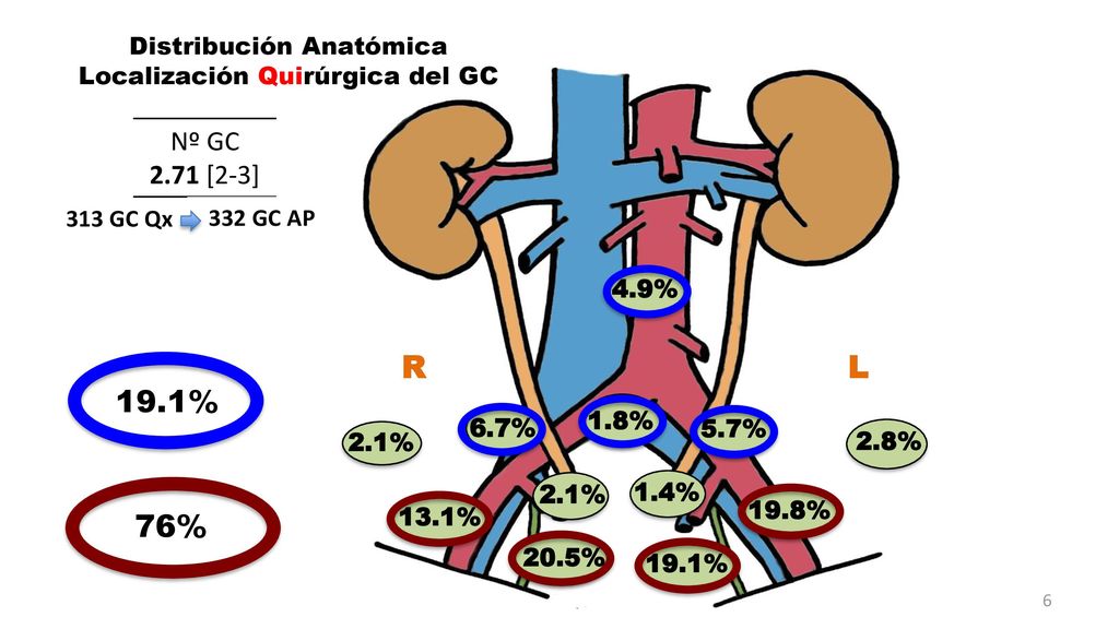 R L 19.1% 76% Nº GC 2.71 [2-3] Distribución Anatómica