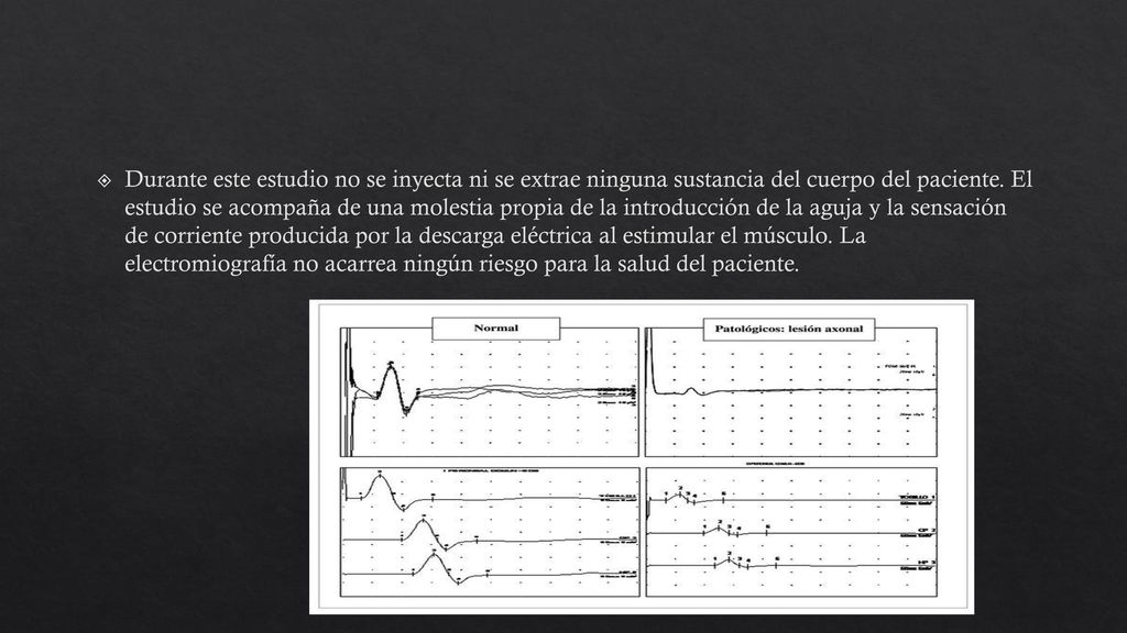 Durante este estudio no se inyecta ni se extrae ninguna sustancia del cuerpo del paciente.