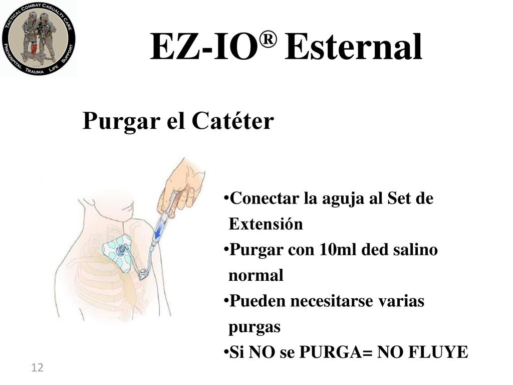 EZ-IO® Esternal Purgar el Catéter Conectar la aguja al Set de