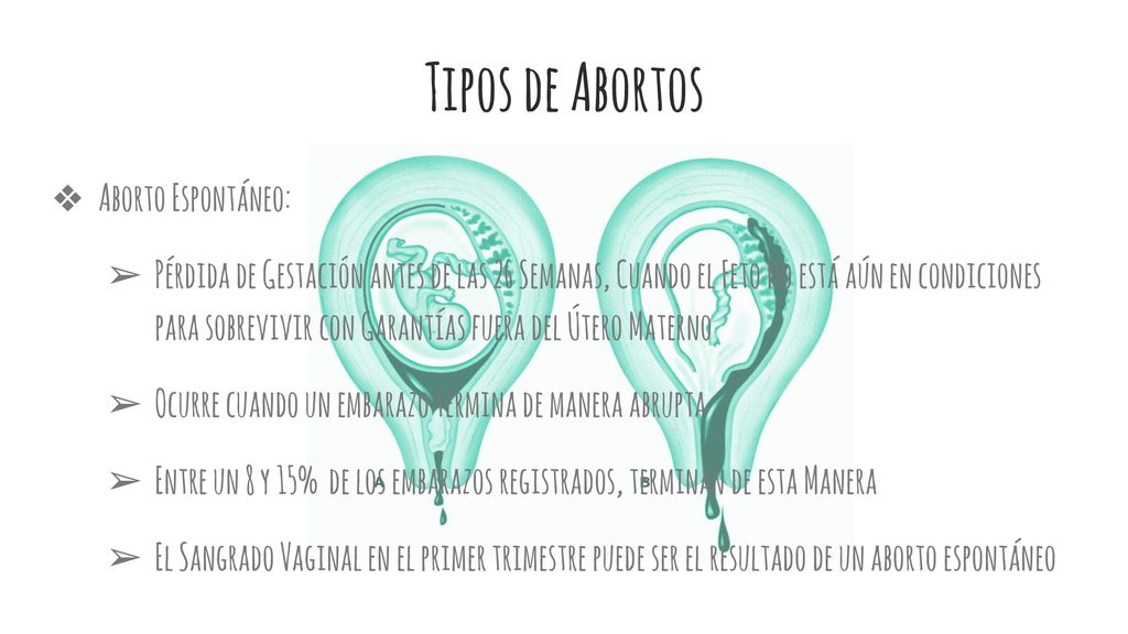 Tipos de Abortos Aborto Espontáneo:
