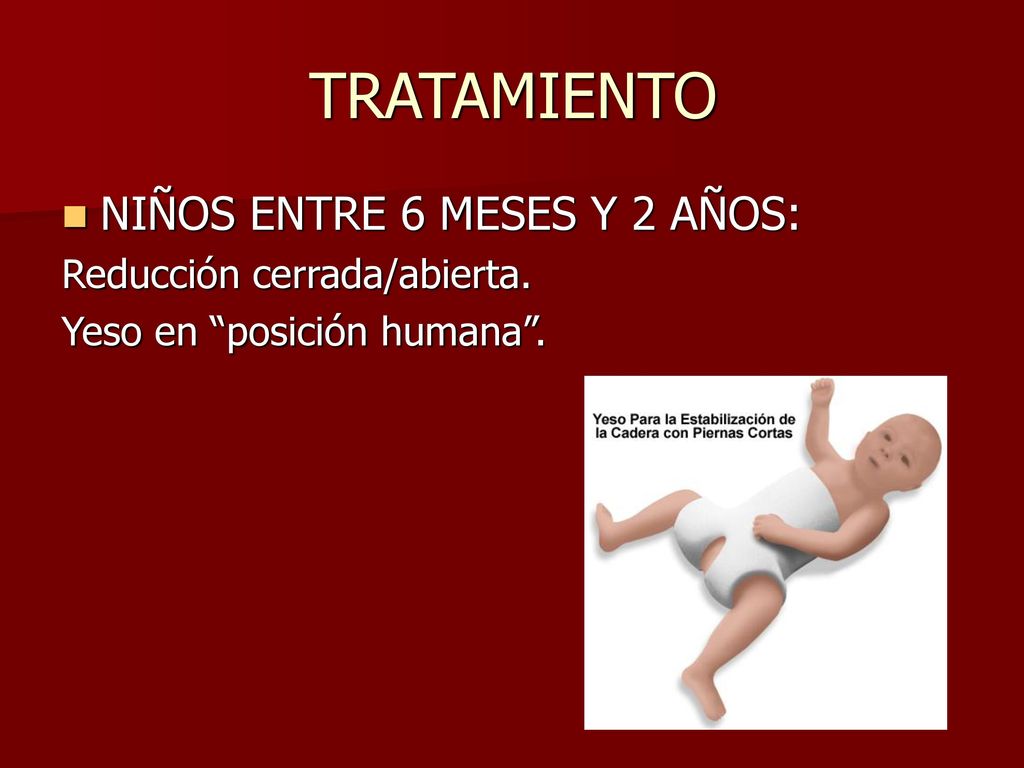 TRATAMIENTO NIÑOS ENTRE 6 MESES Y 2 AÑOS: Reducción cerrada/abierta.