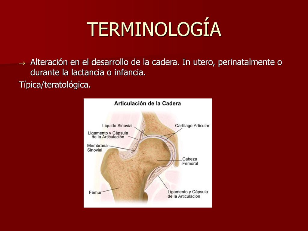 TERMINOLOGÍA Alteración en el desarrollo de la cadera. In utero, perinatalmente o durante la lactancia o infancia.