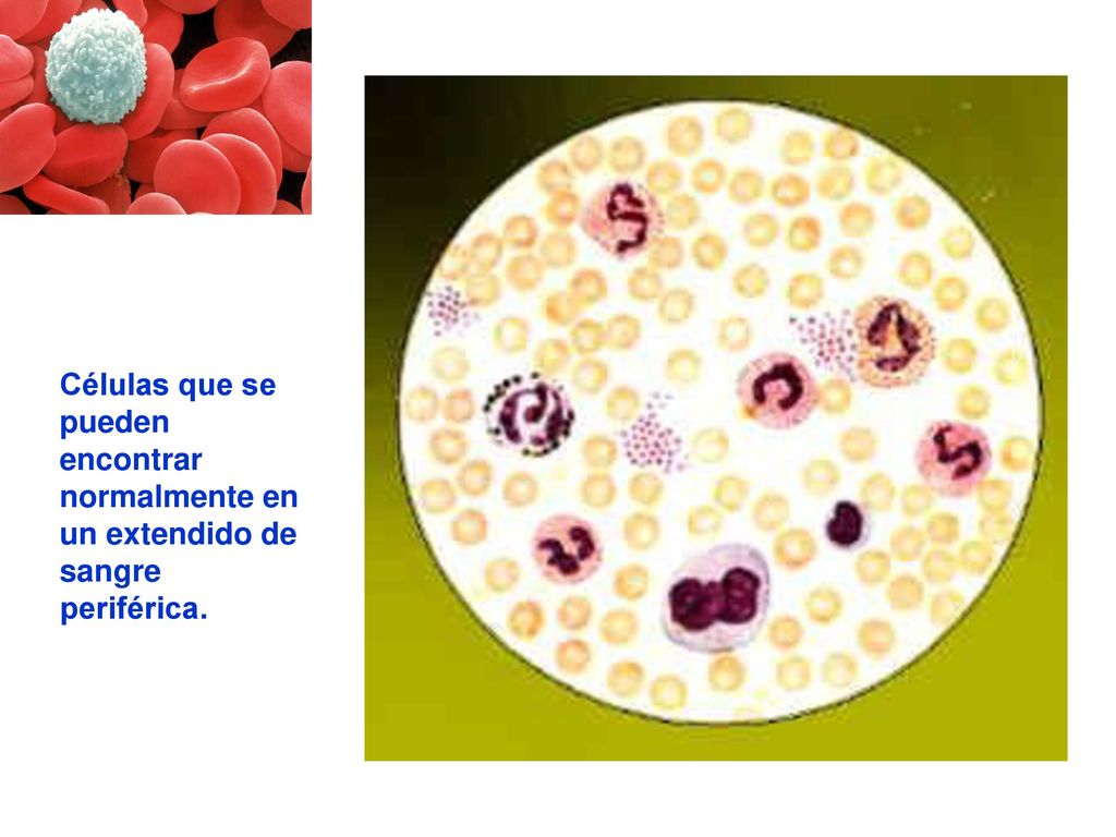 Células que se pueden encontrar normalmente en un extendido de sangre periférica.