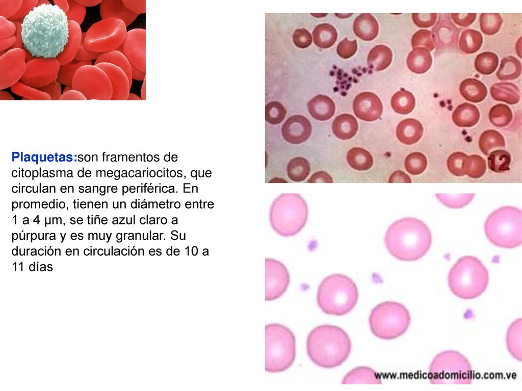 Plaquetas:son framentos de citoplasma de megacariocitos, que circulan en sangre periférica.