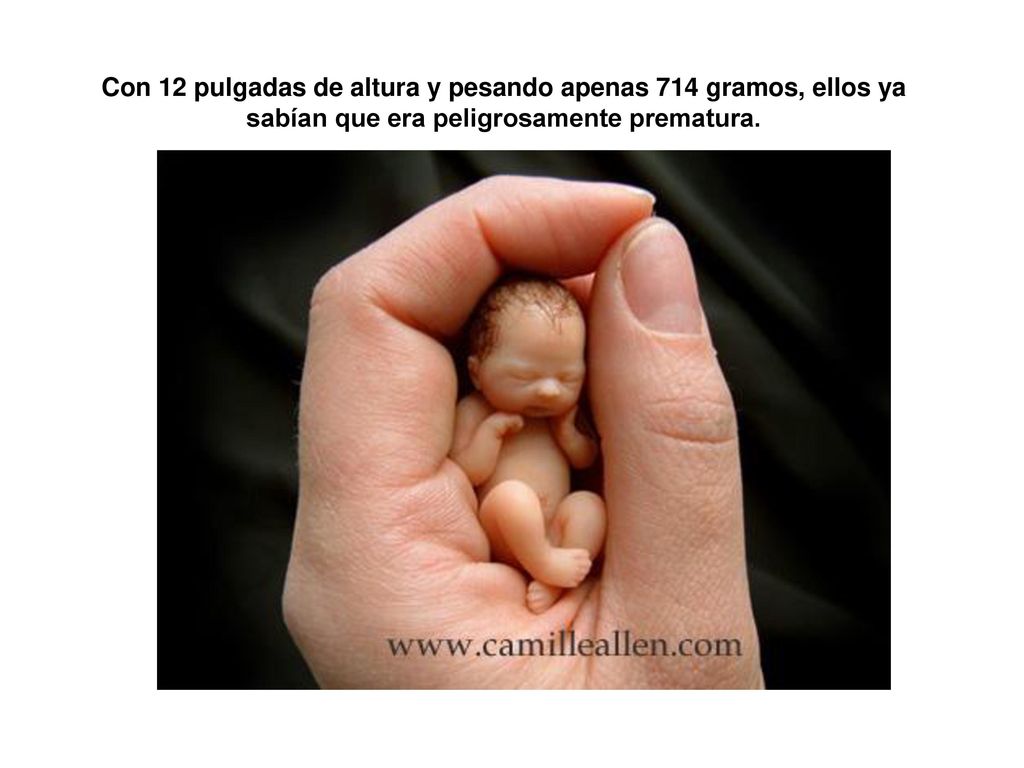 Con 12 pulgadas de altura y pesando apenas 714 gramos, ellos ya sabían que era peligrosamente prematura.