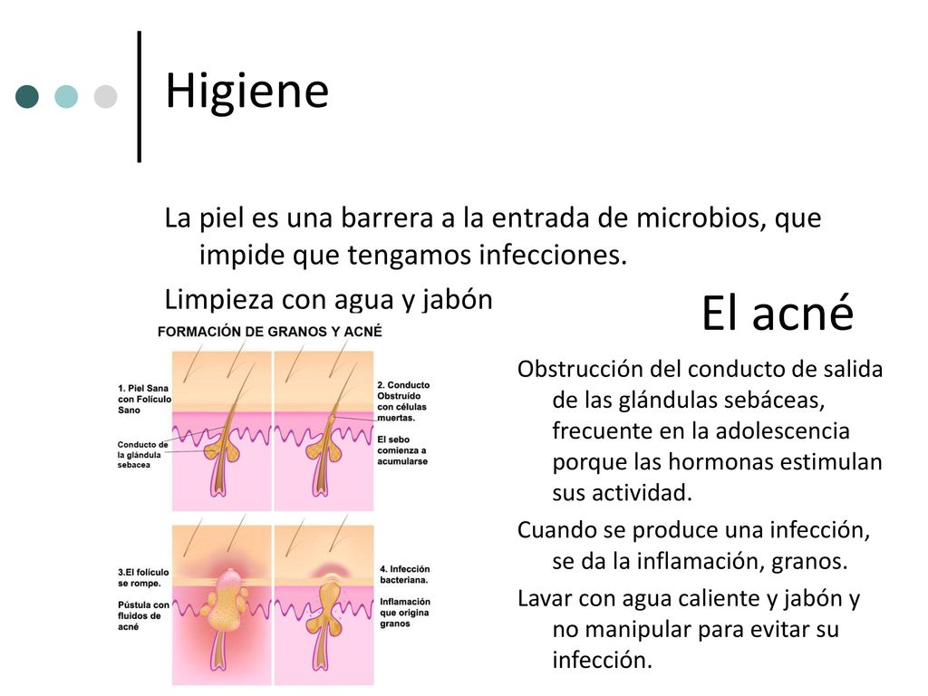 Higiene La piel es una barrera a la entrada de microbios, que impide que tengamos infecciones. Limpieza con agua y jabón.