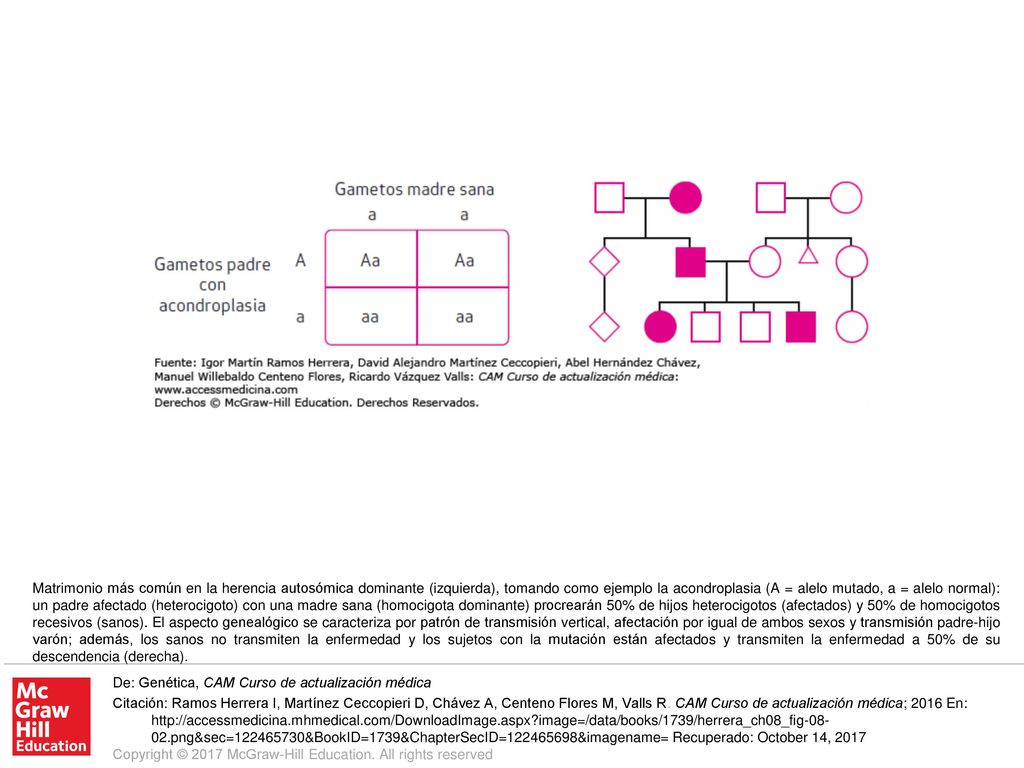 Matrimonio más común en la herencia autosómica dominante (izquierda), tomando como ejemplo la acondroplasia (A = alelo mutado, a = alelo normal): un padre afectado (heterocigoto) con una madre sana (homocigota dominante) procrearán 50% de hijos heterocigotos (afectados) y 50% de homocigotos recesivos (sanos). El aspecto genealógico se caracteriza por patrón de transmisión vertical, afectación por igual de ambos sexos y transmisión padre-hijo varón; además, los sanos no transmiten la enfermedad y los sujetos con la mutación están afectados y transmiten la enfermedad a 50% de su descendencia (derecha).