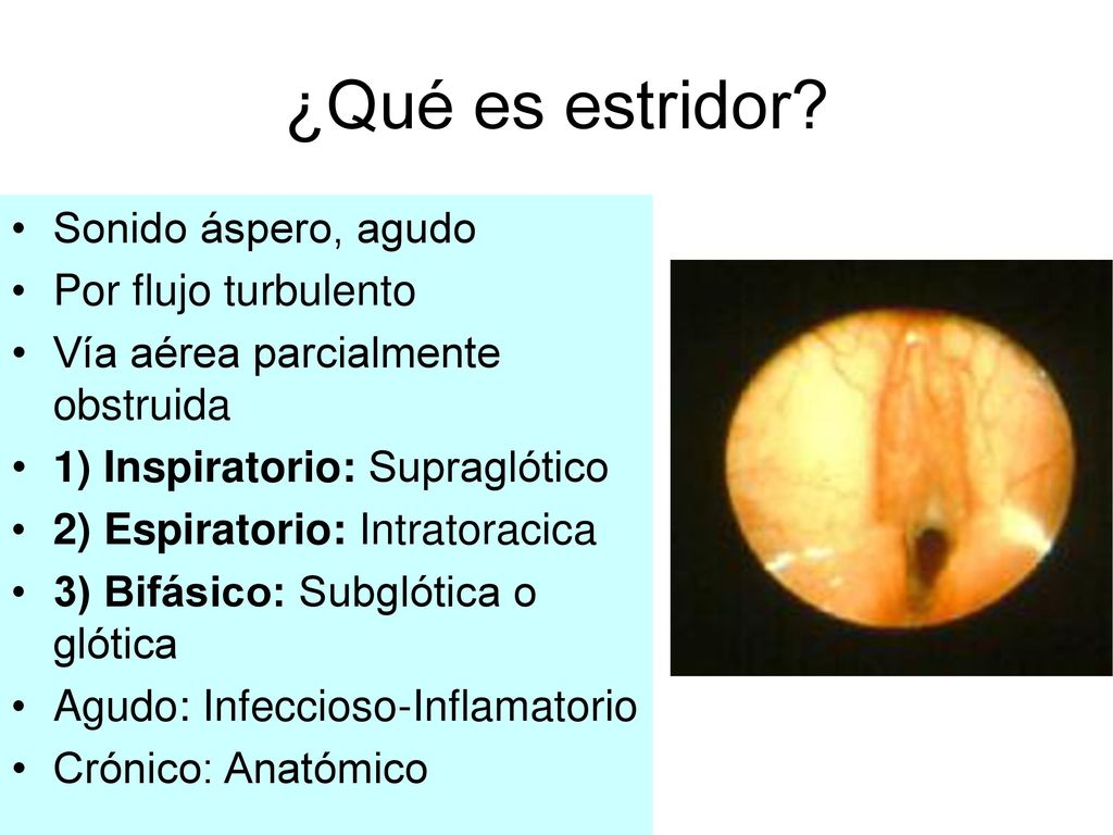 ¿Qué es estridor Sonido áspero, agudo Por flujo turbulento