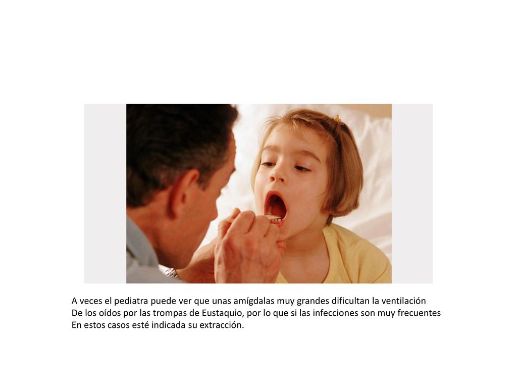 A veces el pediatra puede ver que unas amígdalas muy grandes dificultan la ventilación