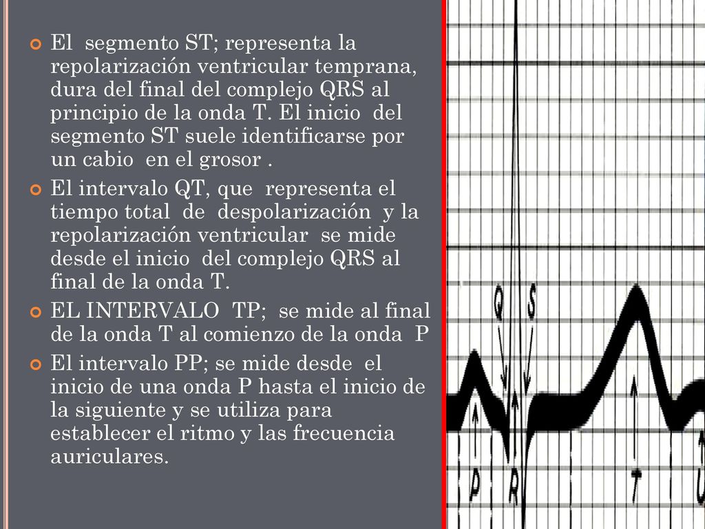 El segmento ST; representa la repolarización ventricular temprana, dura del final del complejo QRS al principio de la onda T. El inicio del segmento ST suele identificarse por un cabio en el grosor .