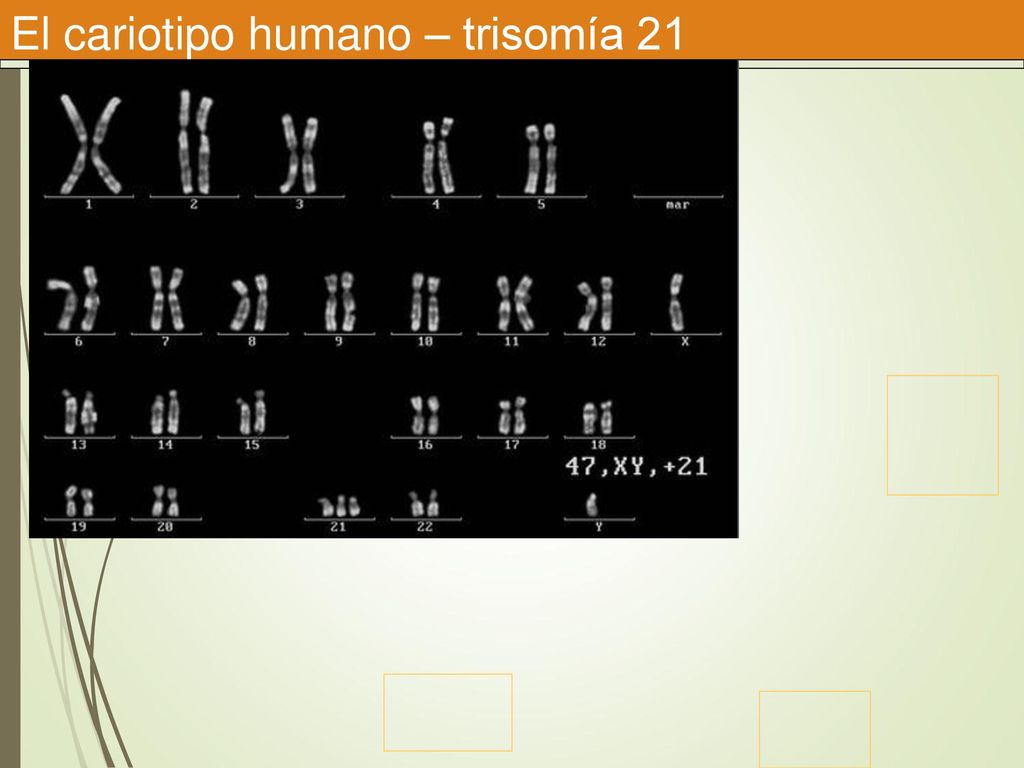 El cariotipo humano – trisomía 21