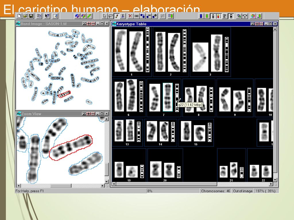 El cariotipo humano – elaboración