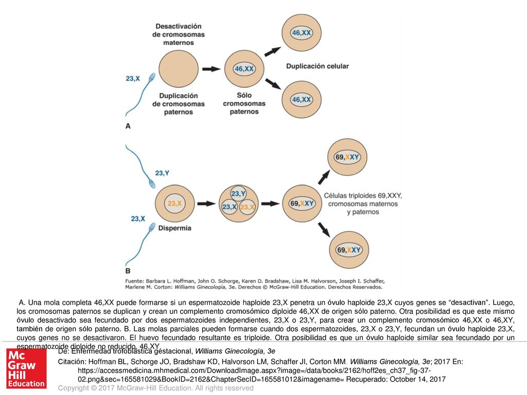 A. Una mola completa 46,XX puede formarse si un espermatozoide haploide 23,X penetra un óvulo haploide 23,X cuyos genes se desactivan . Luego, los cromosomas paternos se duplican y crean un complemento cromosómico diploide 46,XX de origen sólo paterno. Otra posibilidad es que este mismo óvulo desactivado sea fecundado por dos espermatozoides independientes, 23,X o 23,Y, para crear un complemento cromosómico 46,XX o 46,XY, también de origen sólo paterno. B. Las molas parciales pueden formarse cuando dos espermatozoides, 23,X o 23,Y, fecundan un óvulo haploide 23,X, cuyos genes no se desactivaron. El huevo fecundado resultante es triploide. Otra posibilidad es que un óvulo haploide similar sea fecundado por un espermatozoide diploide no reducido, 46,XY.