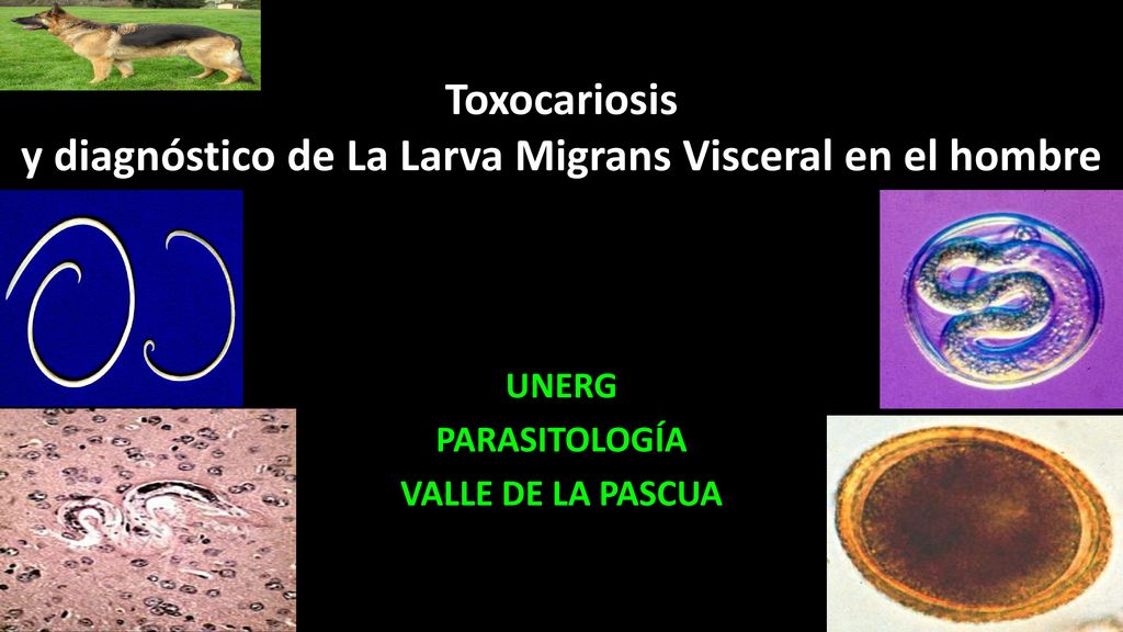 Toxocariosis y diagnóstico de La Larva Migrans Visceral en el hombre