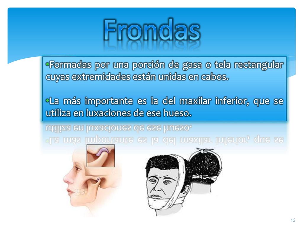 Frondas Formadas por una porción de gasa o tela rectangular cuyas extremidades están unidas en cabos.