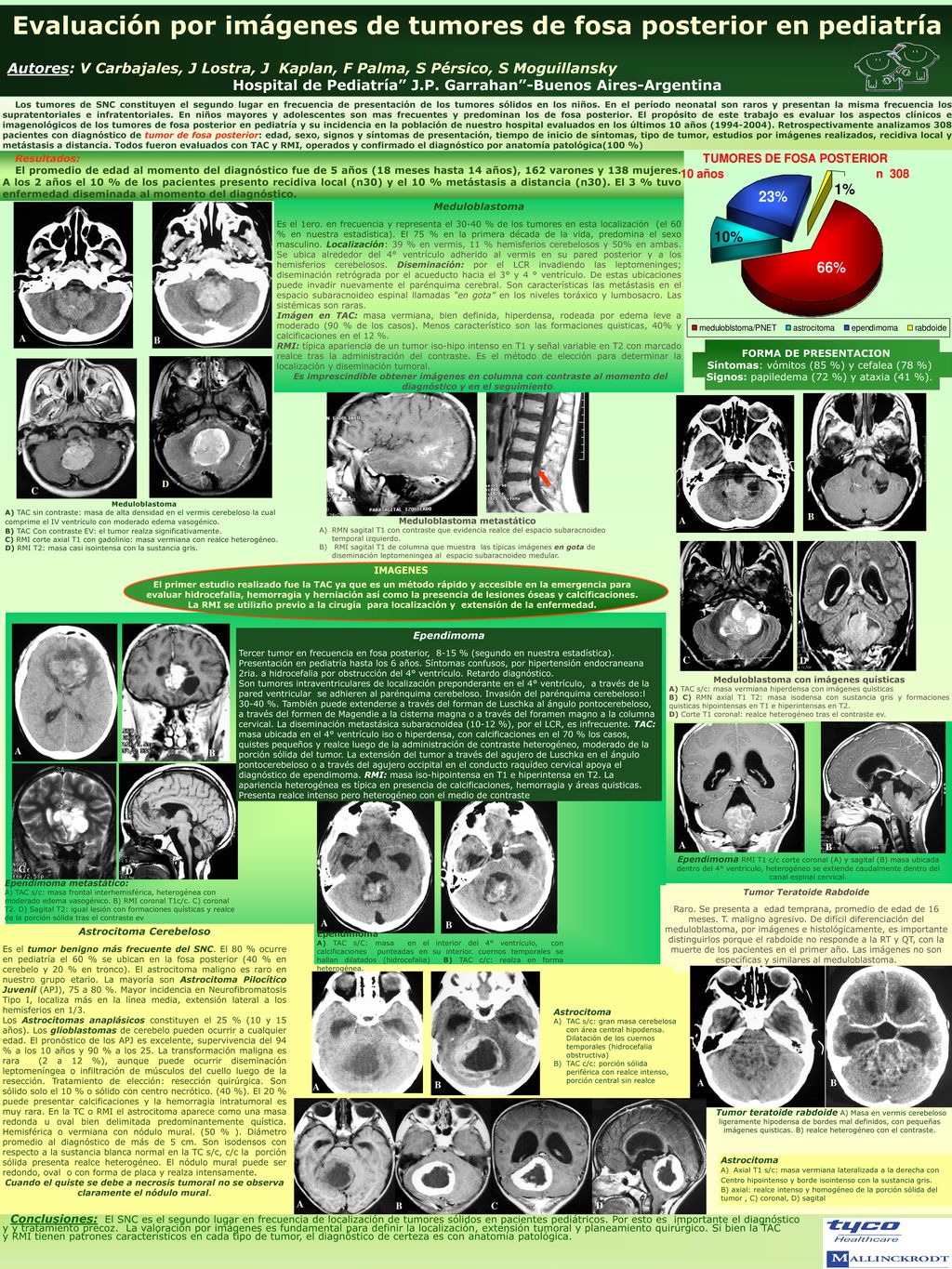 Evaluación por imágenes de tumores de fosa posterior en pediatría