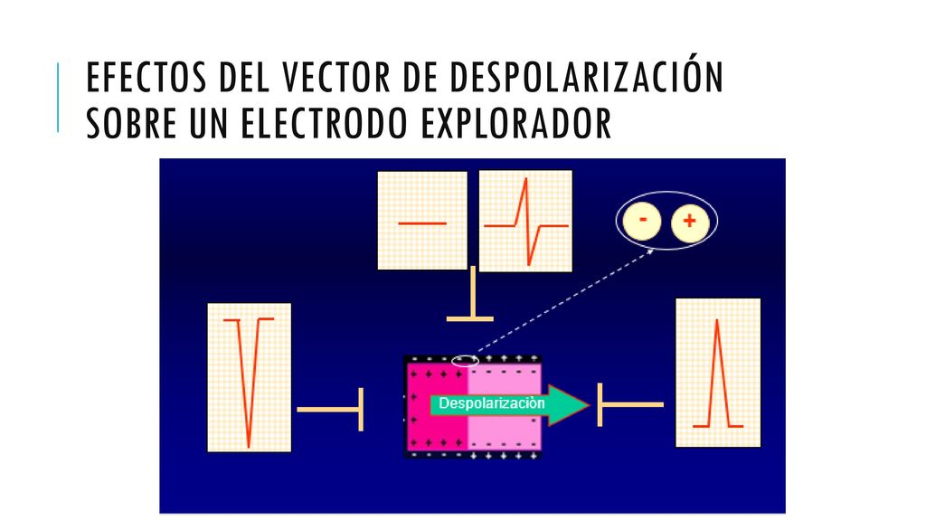 Efectos del vector de despolarización sobre un electrodo explorador