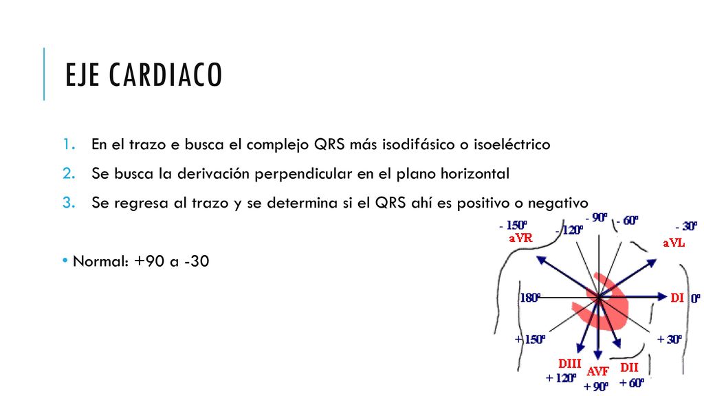 Eje cardiaco En el trazo e busca el complejo QRS más isodifásico o isoeléctrico. Se busca la derivación perpendicular en el plano horizontal.