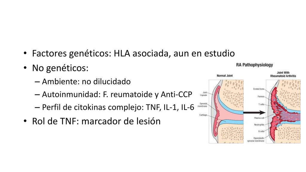 Factores genéticos: HLA asociada, aun en estudio No genéticos: